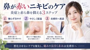 鼻が赤いニキビを触らず冷やし、やさしく保湿して必要なら皮膚科へ相談するケアを示すBeauty Board