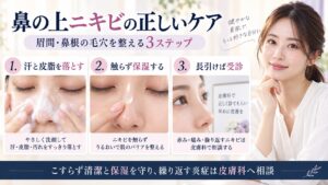 鼻の上や眉間のニキビを汗と皮脂から整え、触らず保湿し長引けば皮膚科へ相談するケアを示すBeauty Board