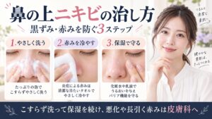 鼻の上のニキビをやさしく洗い、赤みを冷やして保湿で守る正しい毛穴ケアを示すBeauty Board