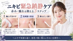 ニキビを触らず冷やし、低刺激で保湿して薬を正しく使う緊急鎮静ケアを示すBeauty Board