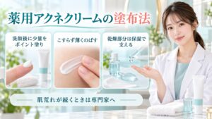 薬用アクネクリームの塗布法を3ステップで示す美容ボード