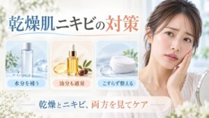 乾燥肌ニキビの対策を解説する女性アドバイザーと3枚のスキンケアカード