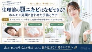 Chocobra 6769-pms-chin-acne-causes-and-care eyecatch