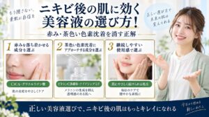 Chocobra 6773-post-acne-care-serum-guide eyecatch