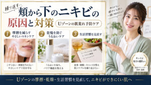 頬から下のニキビができる原因と対策！Uゾーンの肌荒れ予防ケア アイキャッチ