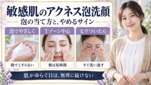 敏感肌のアクネス泡洗顔