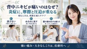 背中ニキビが痛い原因は？毛穴の奥の炎症を鎮めるボディケアの要点を3つの写真カードで説明
