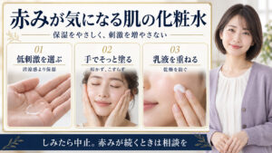赤みが気になる肌の化粧水。低刺激を選び、手でそっと塗り、乳液を重ねる。しみたら中止し赤みが続くときは相談する。