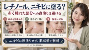 レチノールはニキビに直接塗るべき？肌荒れを防ぐ正しい塗り方と注意点